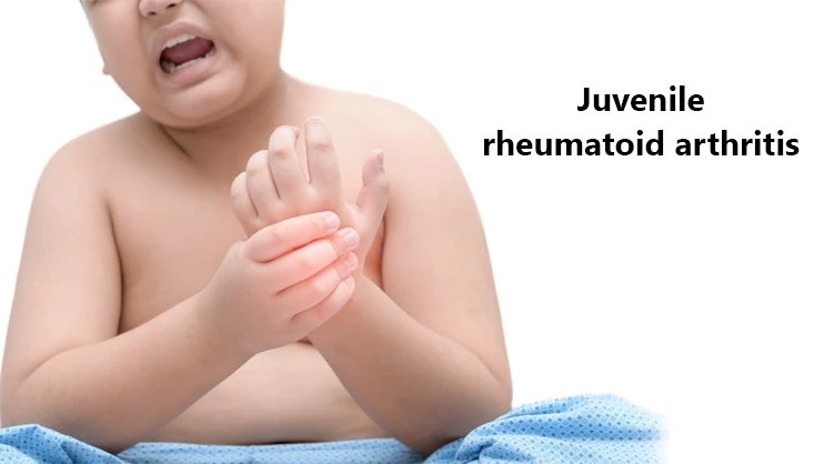Juvenile Rheumatoid Arthritis Symptom