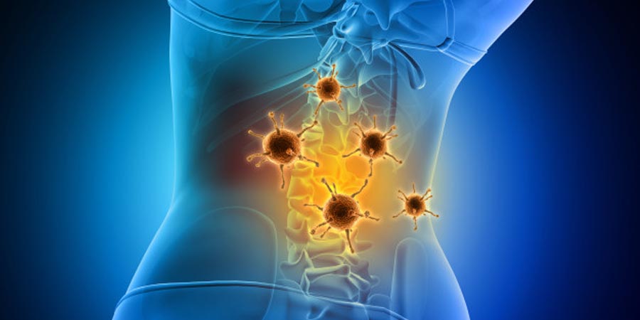 Spinal Infection | Causes, Symptoms, Diagnosis, and Treatment