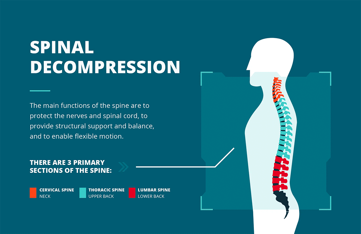 Spinal Decompression Therapy | Procedure, Benefits & Side Effects